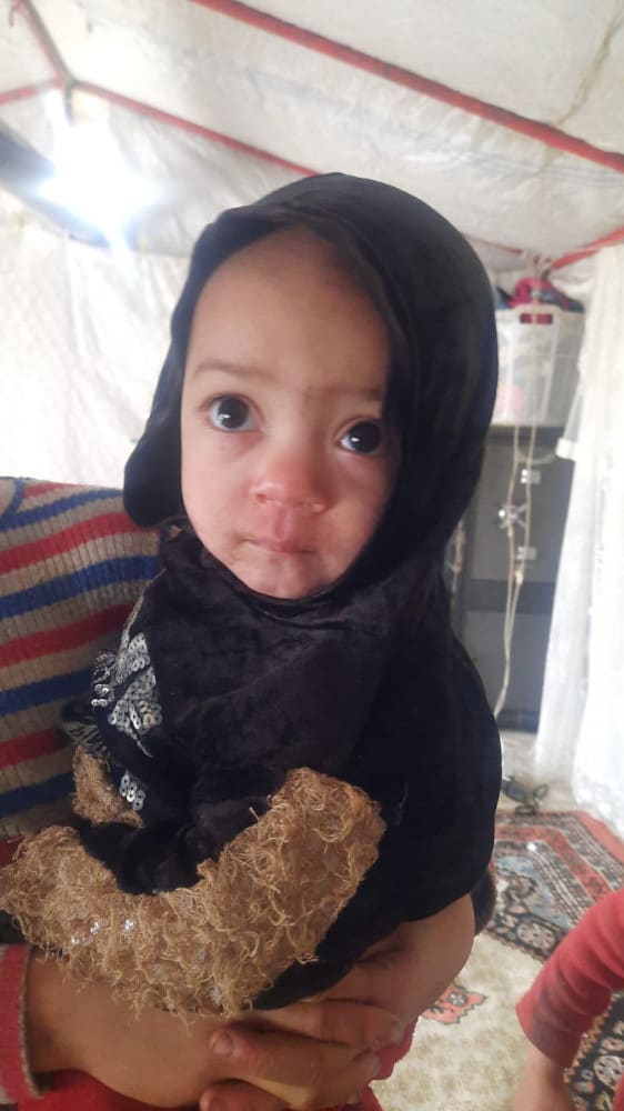 A little girl with an undiagnosed bone density condition, whose father had made homemade arm casts for prior to receiving support from TIAFI.